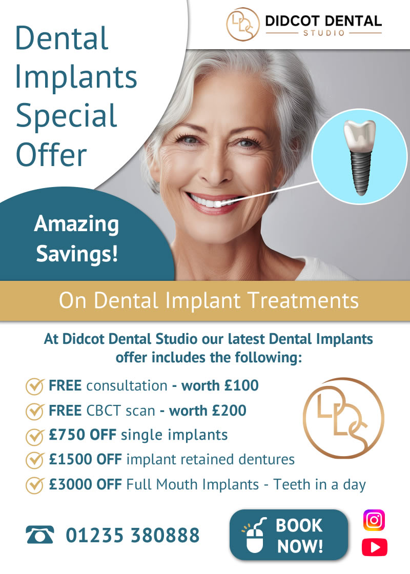 Dental Implant Special Offer 2025